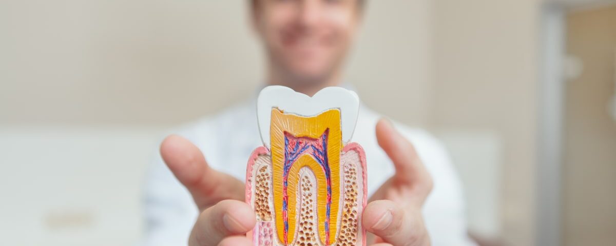 How Much Does a Root Canal Cost in Ahwatukee, Phoenix