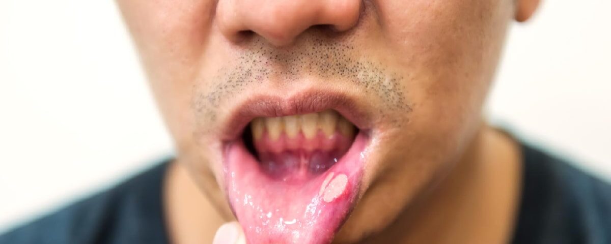 How Much Does It Cost to Remove a Lesion in Ahwatukee, Phoenix