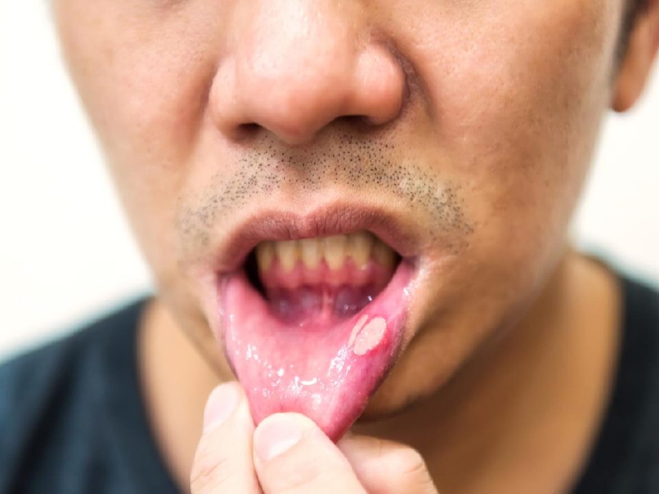 How Much Does It Cost to Remove a Lesion in Ahwatukee, Phoenix