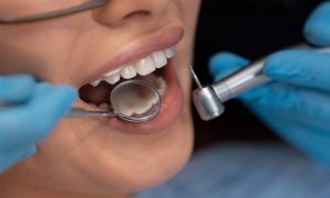 Same Day Crowns Cost in Phoenix