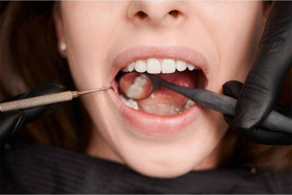Common Causes of Tooth Pain Without a Cavity