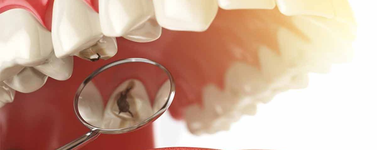 tooth pain without a cavity