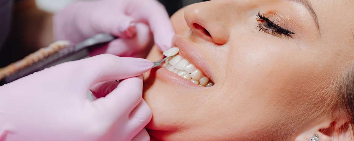 Do Porcelain Veneers Damage Teeth