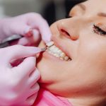 Do Porcelain Veneers Damage Teeth