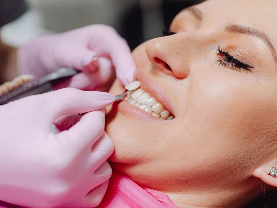 Do Porcelain Veneers Damage Teeth