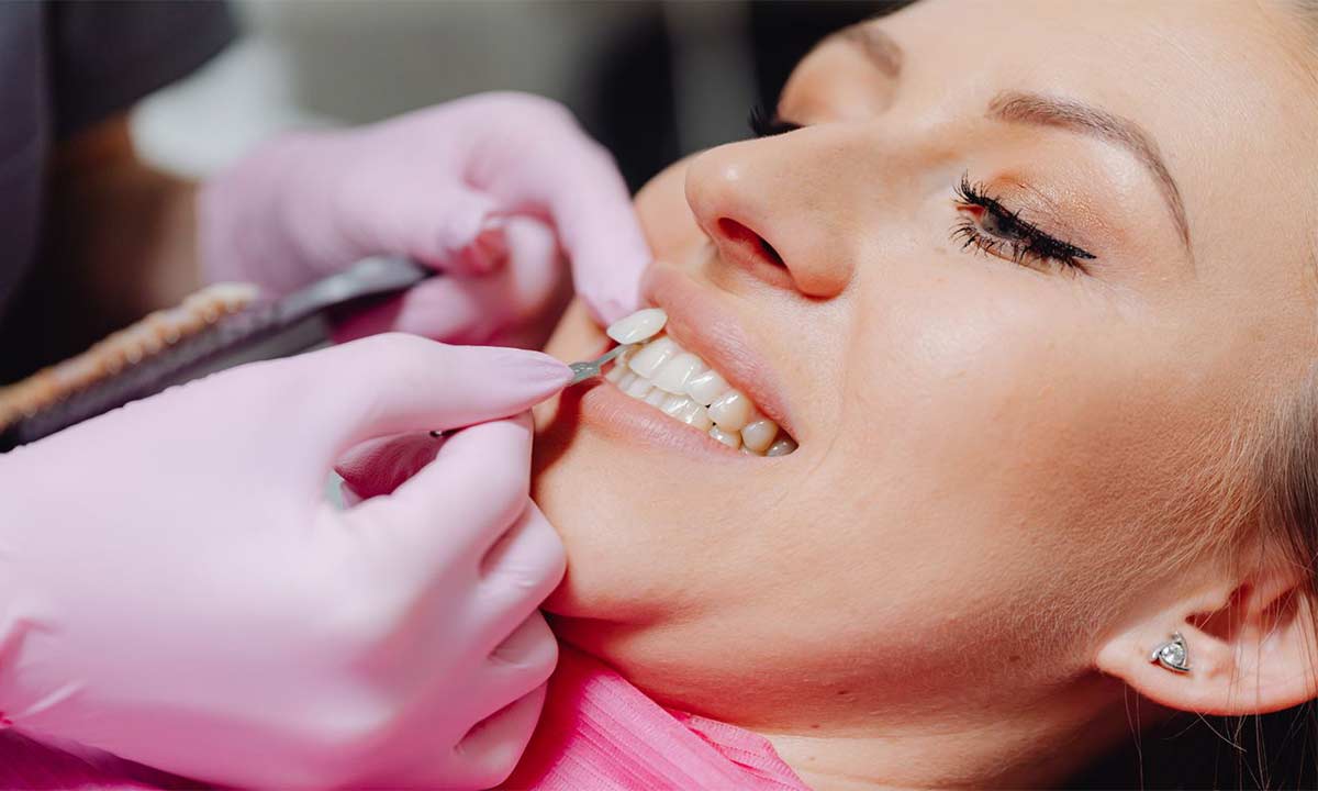 Do Porcelain Veneers Damage Teeth