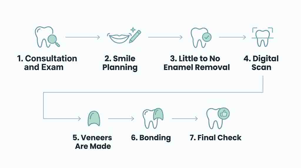 No-Prep Veneers Process