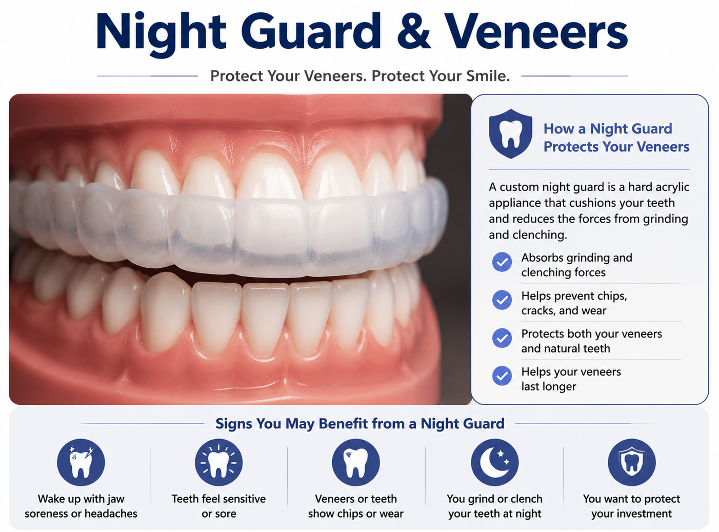 night guard for porcelain veneers