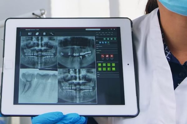 Dental 3D X-ray in Ahwatukee, AZ