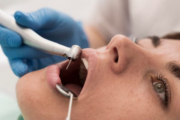 Dental Fillings Phoenix