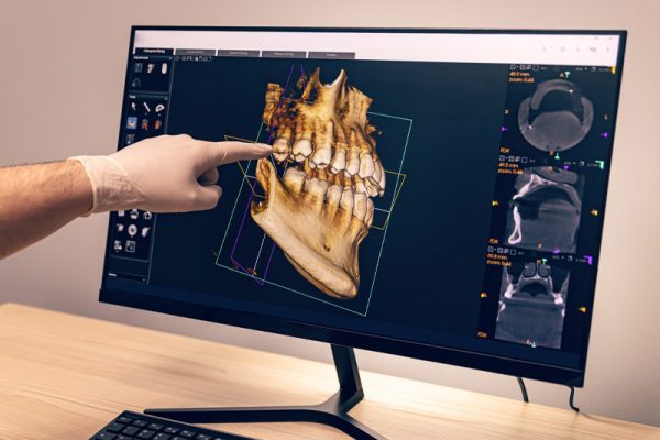 Dental X-rays in Ahwatukee, Phoenix