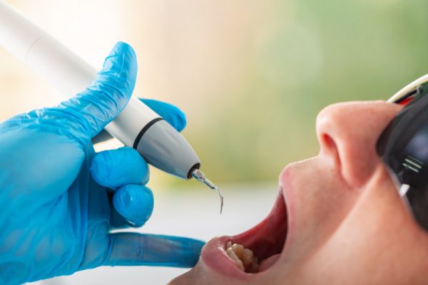 Drill-Free Dentistry in Ahwatukee, Phoenix