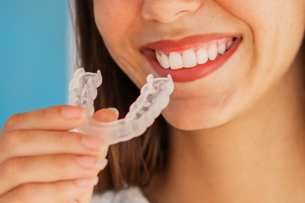 Night Guards in Ahwatukee, Phoenix