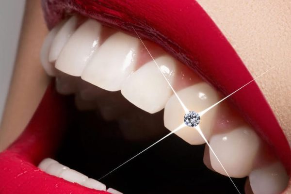 Cosmetics Dentists in Ahwatukee, AZ